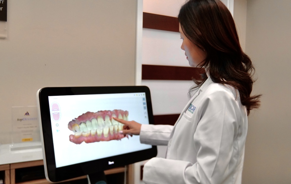 Dr. Jamie Kim studying a patient's iTero intraoral 3D scan on screen, analyzing the digital tooth model to evaluate Invisalign treatment options at iCare Orthodontics in Norcross, GA